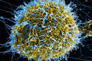 SEM Filamentous Ebola Virus Particles Ver3