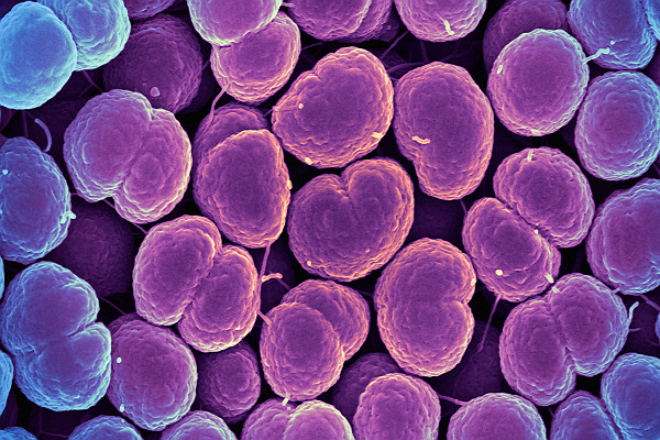 SEM Neisseria Gonorrhoeae Bacteria