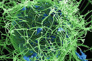 SEM Filamentous Ebola Virus Particles