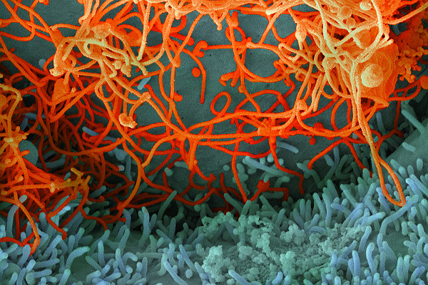 Ebola Virus Isolated On Vero Cells