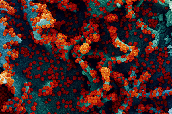 Novel Coronavirus SARS CoV 2 Colorized SEM