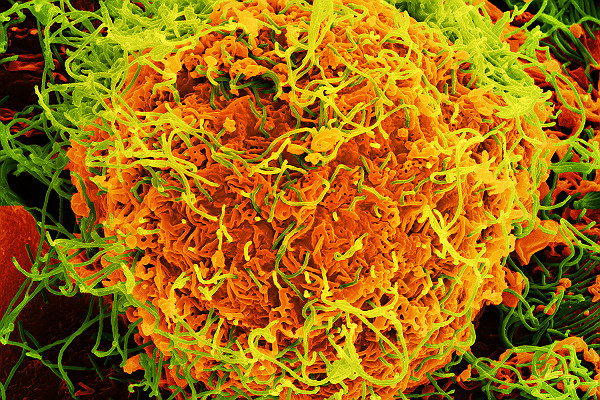 SEM Ebola Virus Particles on Infected VERO E6 Cells