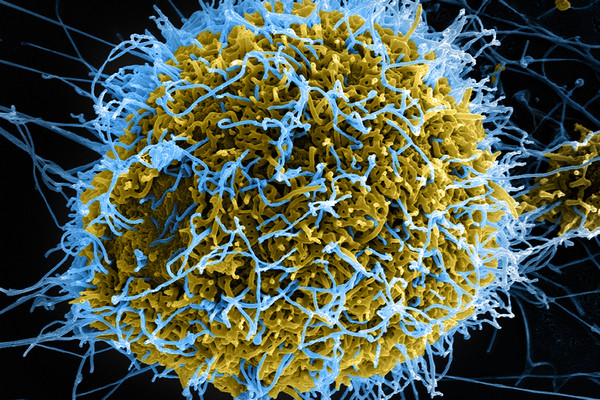 SEM Filamentous Ebola Virus Particles Ver3