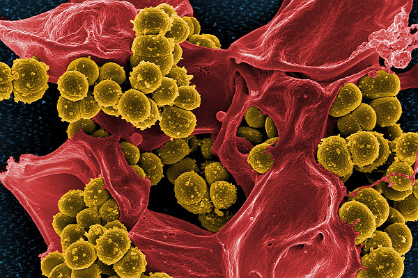 SEM Methicillin Resistant Staphylococcus Aureus Bacteria