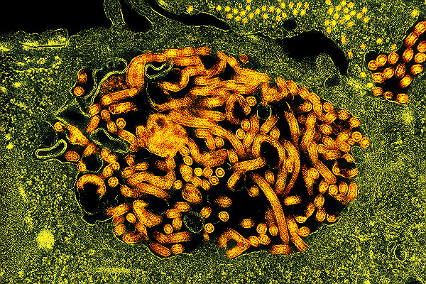 TEM Ebola Virus Nucleocapsids and Virus Particles