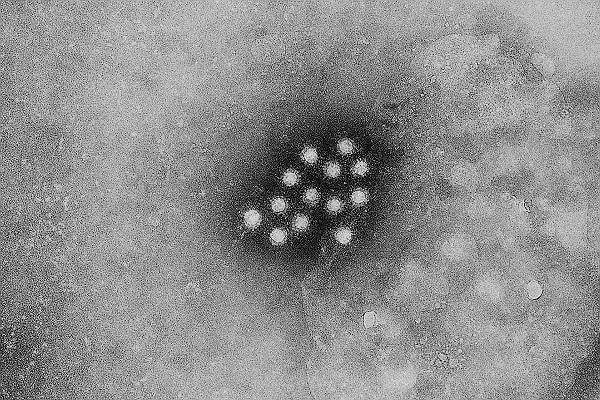 TEM Image Hepatitis A Virus RNA