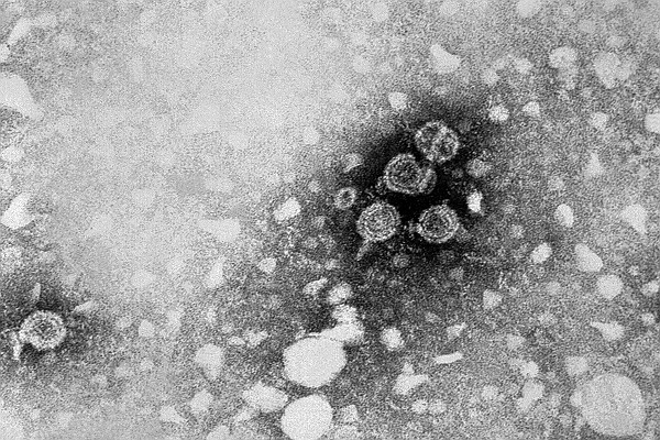 TEM Image Hepatitis B Virus Particles