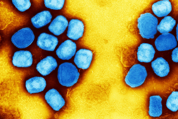 TEM Monkeypox Virus Particles Ver1