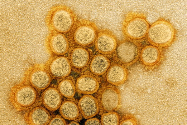 TEM Novel Coronavirus SARS CoV 2 UK B117