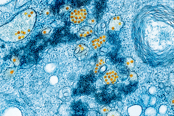 TEM Vero E6 Cells Infected with Yellow Fever Virus