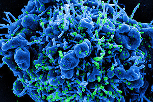 Novel Coronavirus SARS CoV 2 Infecting Apoptotic Cell