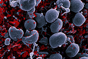 SEM Apoptotic Cell Infected with SARS CoV 2 Virus