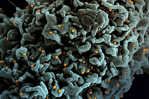 SEM Cell Infected with UK B117 Variant SARS CoV 2 Virus Ver2