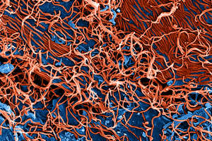SEM Filamentous Ebola Virus Particles Ver2