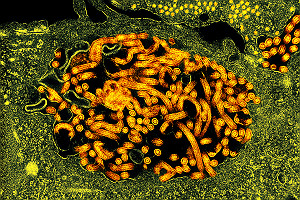 TEM Ebola Virus Nucleocapsids and Virus Particles