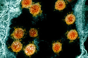 TEM SARS CoV 2 Virus Particles